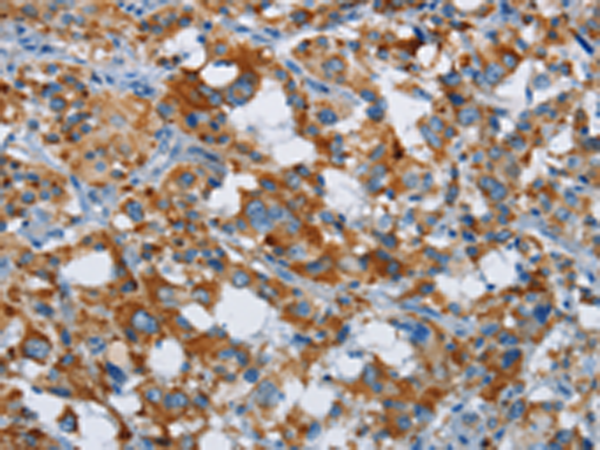 Anti-ETHE1 Rabbit Polyclonal Antibody