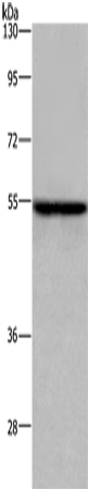 Anti-ETS2 Rabbit Polyclonal Antibody