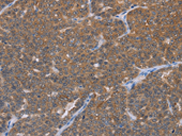 Anti-FABP6 Rabbit Polyclonal Antibody