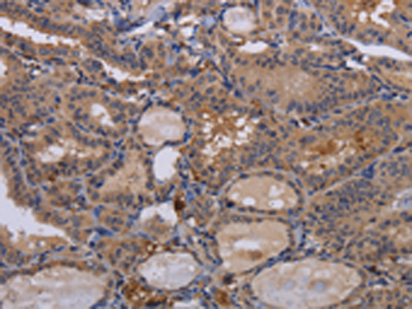 Anti-FADS1 Rabbit Polyclonal Antibody
