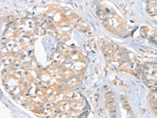 Anti-Fas Apoptotic Inhibitory Molecule 3 Rabbit Polyclonal Antibody