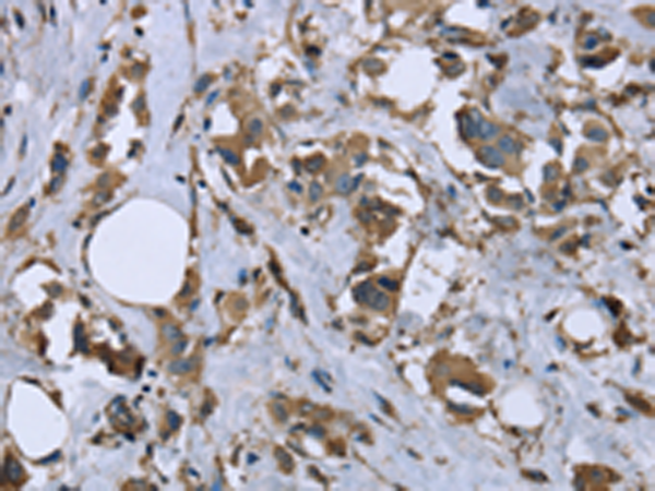 Anti-MYL12B Rabbit Polyclonal Antibody