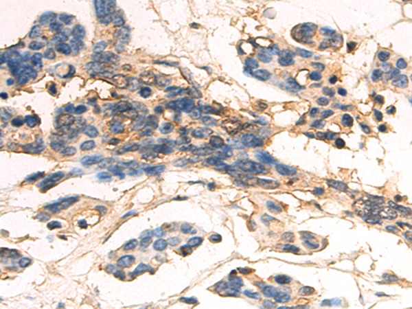 Anti-FGF18 Rabbit Polyclonal Antibody