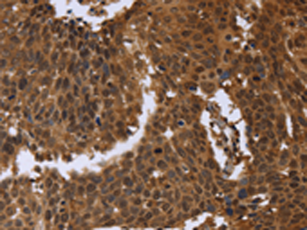 Anti-FGFRL1 Rabbit Polyclonal Antibody