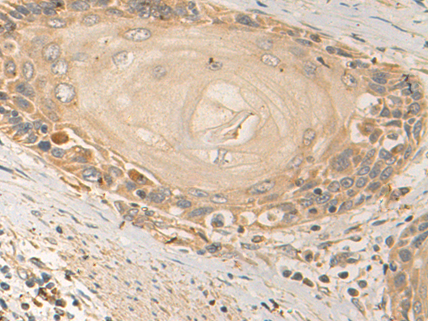 Anti-FGL2 Rabbit Polyclonal Antibody