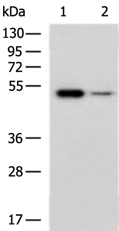 Anti-FGL2 Rabbit Polyclonal Antibody