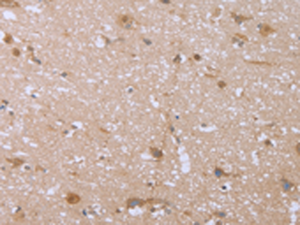 Anti-FHL2 Rabbit Polyclonal Antibody