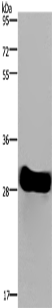Anti-FHL2 Rabbit Polyclonal Antibody