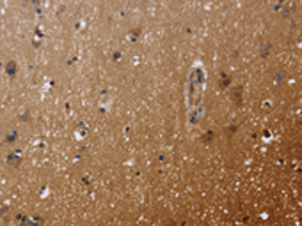 Anti-FHL3 Rabbit Polyclonal Antibody