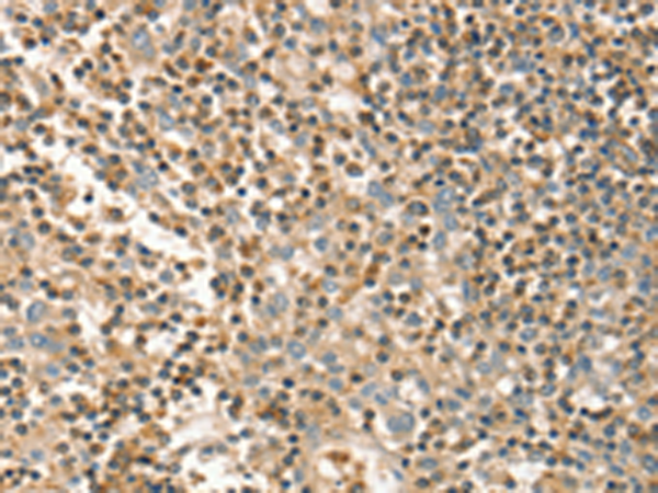 Anti-FMNL1 Rabbit Polyclonal Antibody