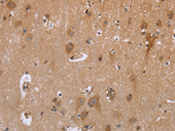 Anti-GABPB2 Rabbit Polyclonal Antibody