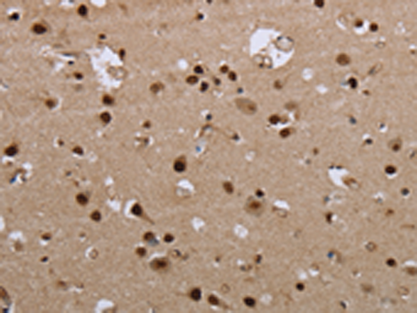Anti-GCKR Rabbit Polyclonal Antibody