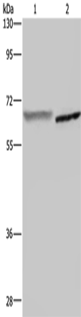 Anti-GCKR Rabbit Polyclonal Antibody