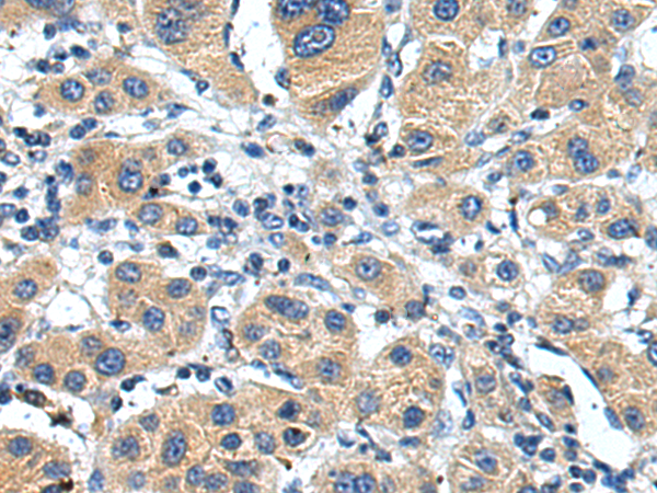 Anti-GGCX Rabbit Polyclonal Antibody