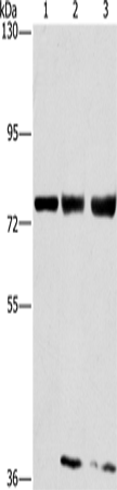 Anti-GGCX Rabbit Polyclonal Antibody