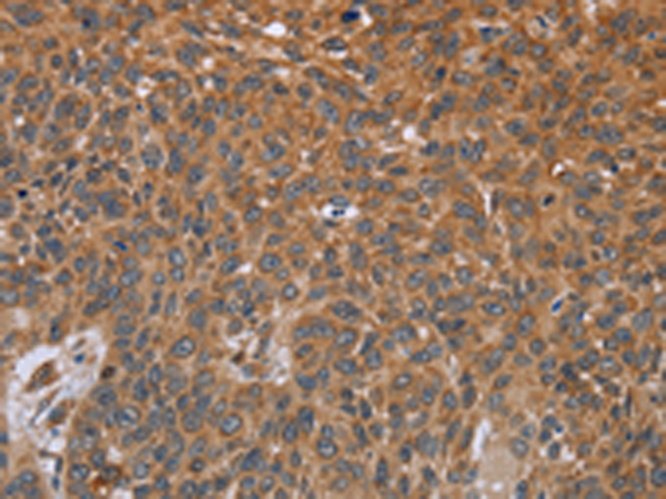 Anti-Growth Hormone 2 Rabbit Polyclonal Antibody