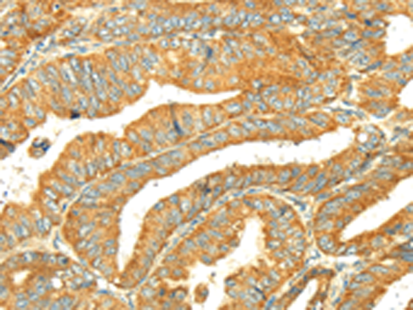 Anti-Glycerol Kinase Rabbit Polyclonal Antibody