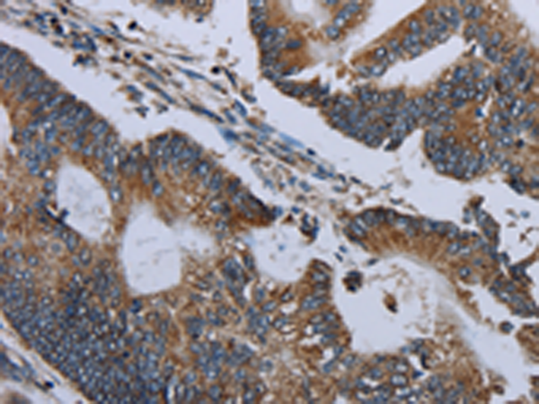 Anti-GRIM19 Rabbit Polyclonal Antibody
