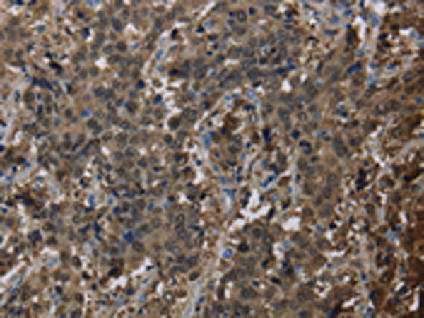 Anti-GSTA3 Rabbit Polyclonal Antibody