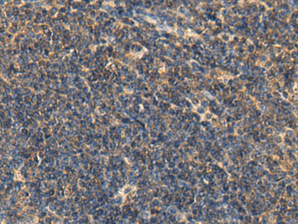 Anti-LIPC Rabbit Polyclonal Antibody