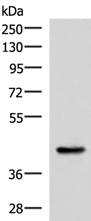 Anti-HPN Rabbit Polyclonal Antibody