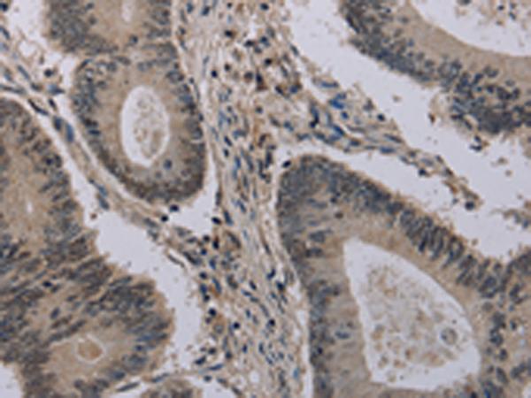 Anti-HIST1H2AH Rabbit Polyclonal Antibody