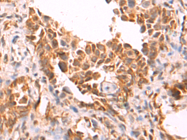Anti-HMGCL Rabbit Polyclonal Antibody