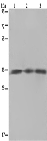 Anti-HMGCL Rabbit Polyclonal Antibody