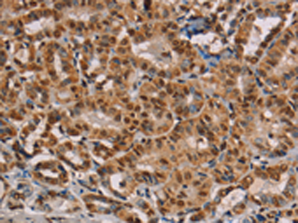 Anti-hnRNP G Rabbit Polyclonal Antibody