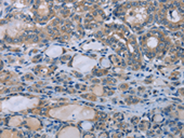 Anti-Homer1 Rabbit Polyclonal Antibody