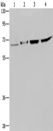 Anti-HACL1 Rabbit Polyclonal Antibody