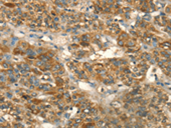 Anti-HSD17B8 Rabbit Polyclonal Antibody