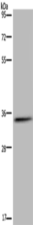 Anti-HSD17B7 Rabbit Polyclonal Antibody