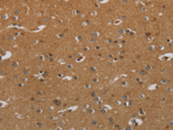 Anti-HSD17B2 Rabbit Polyclonal Antibody