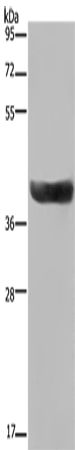 Anti-HSD17B2 Rabbit Polyclonal Antibody