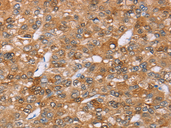 Anti-AKR1C4 Rabbit Polyclonal Antibody
