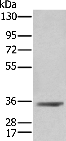 Anti-AKR1C4 Rabbit Polyclonal Antibody
