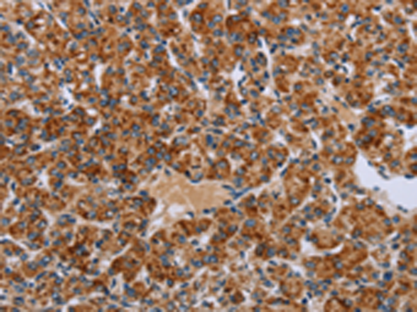 Anti-HSD3B2 Rabbit Polyclonal Antibody