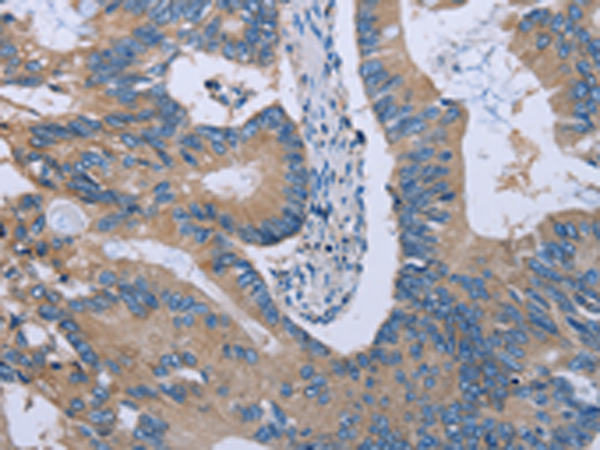 Anti-HYAL3 Rabbit Polyclonal Antibody