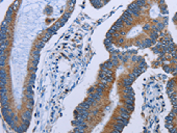 Anti-IDH2 Rabbit Polyclonal Antibody