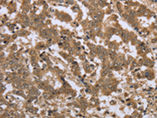 Anti-IKK epsilon Rabbit Polyclonal Antibody