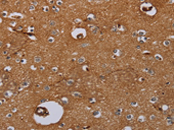 Anti-IL-27 Receptor alpha Rabbit Polyclonal Antibody