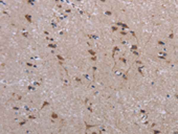 Anti-JAKMIP2 Rabbit Polyclonal Antibody