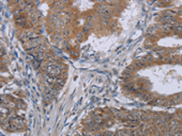 Anti-KLHL2 Rabbit Polyclonal Antibody