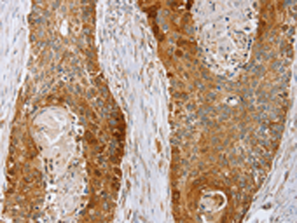 Anti-LMO4 Rabbit Polyclonal Antibody