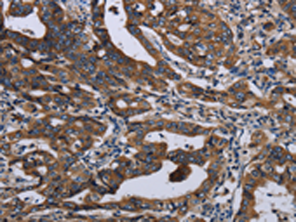 Anti-LZTFL1 Rabbit Polyclonal Antibody