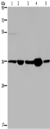 Anti-LZTFL1 Rabbit Polyclonal Antibody