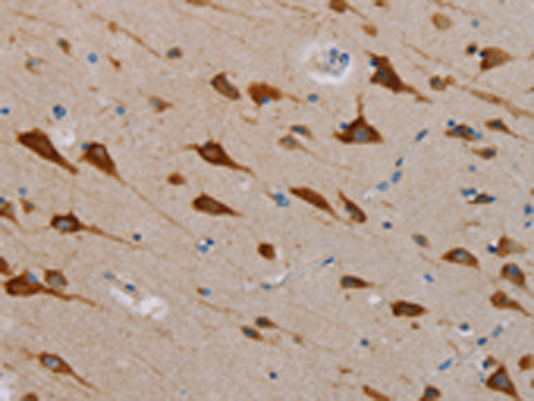 Anti-TAB3 Rabbit Polyclonal Antibody