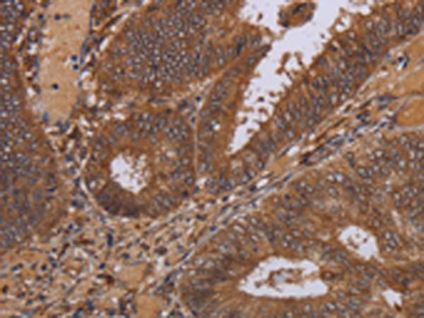 Anti-WDR83 Rabbit Polyclonal Antibody