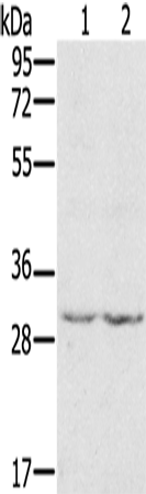 Anti-WDR83 Rabbit Polyclonal Antibody